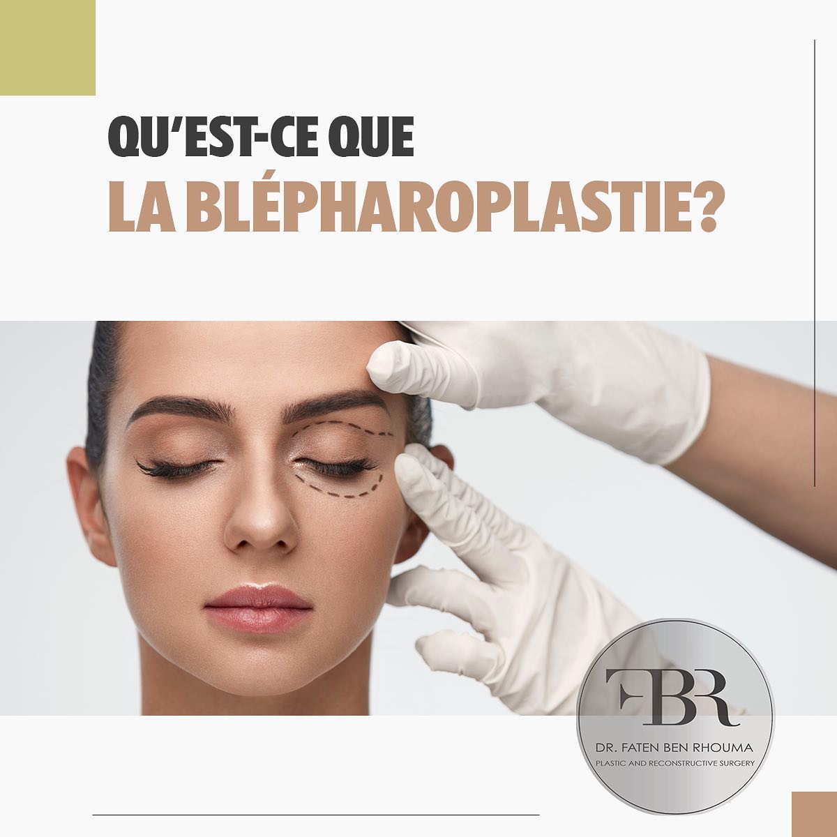 Intervention de blépharoplastie à la clinique du Dr Faten Ben Rhouma